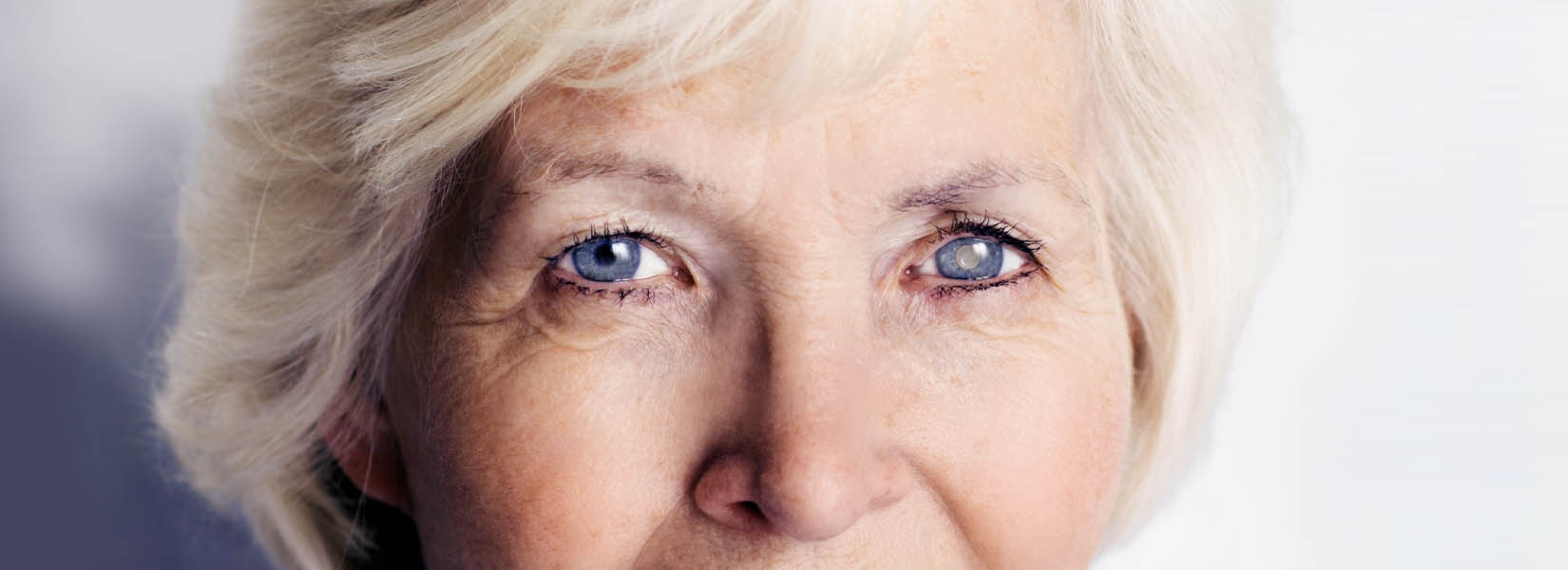 Cataract Surgery in Ballwin