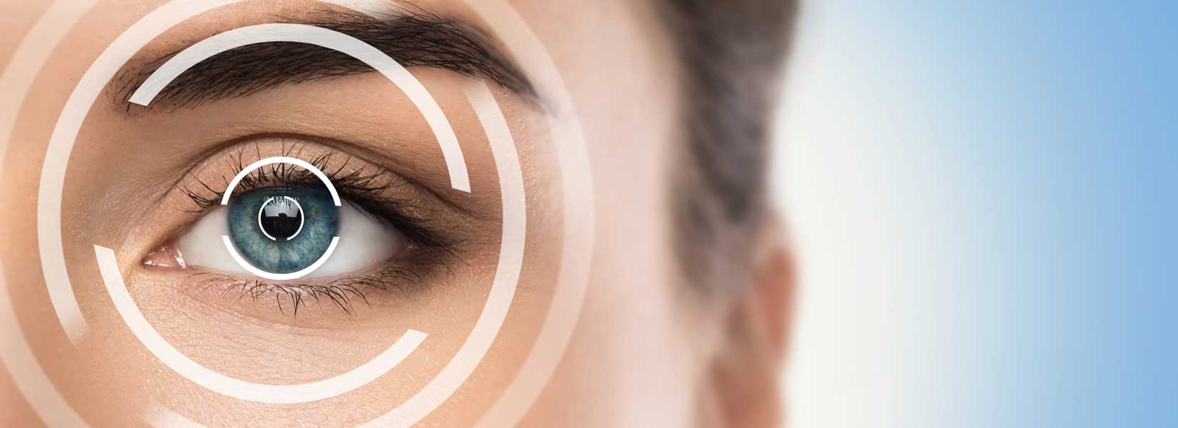 LASIK & Refractive Surgery Co-Management in Ballwin